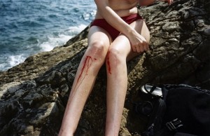 Bleed to prove that you're alive.